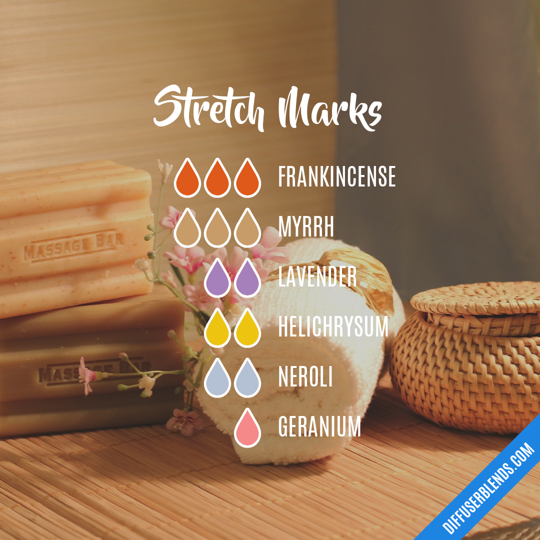 Stretch Marks — Essential Oil Diffuser Blend